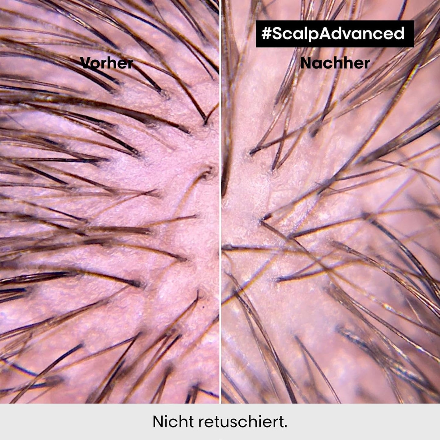 L'Oréal Professionnel Serie Expert Scalp Advanced Anti-Fettend Dermo Purifier Shampoo