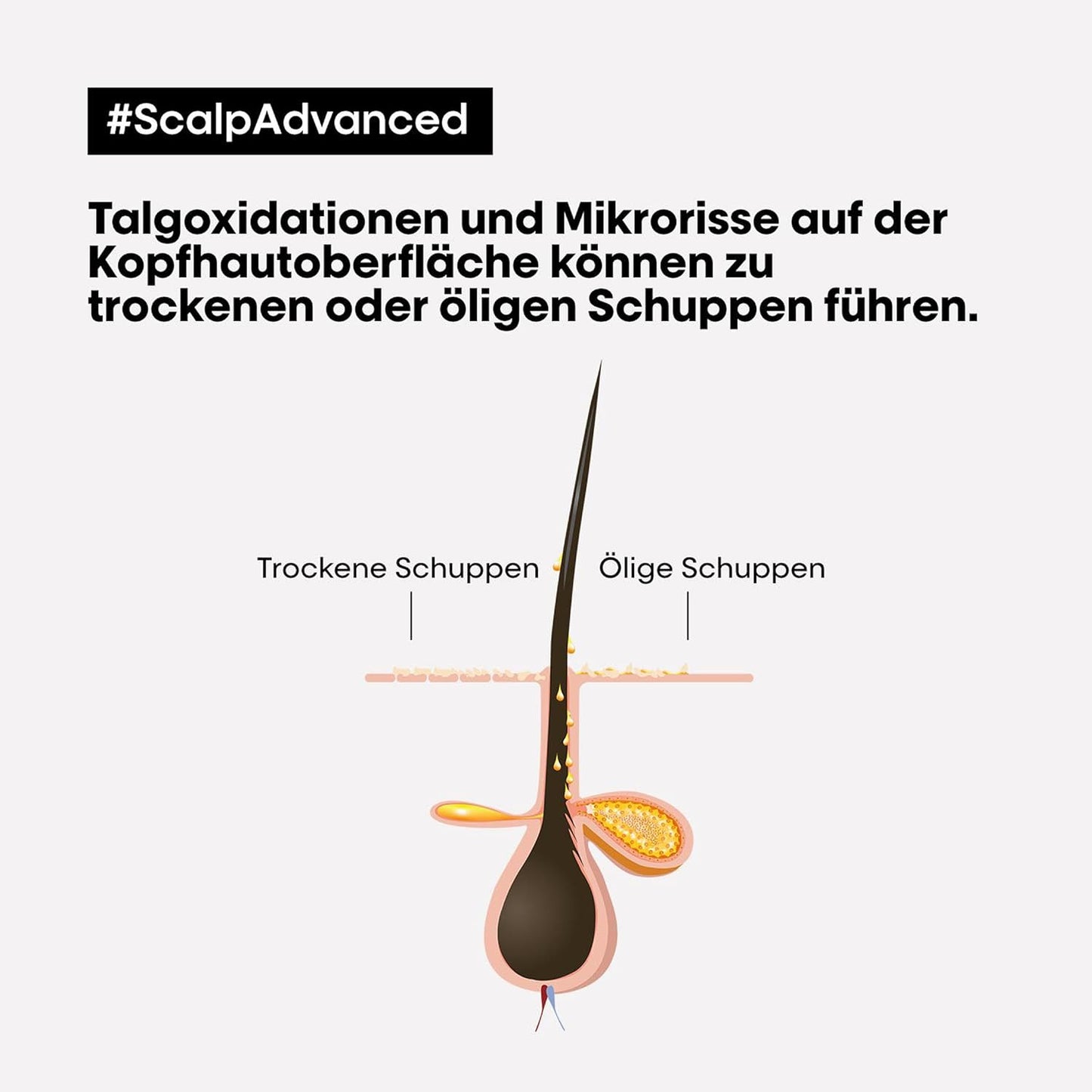 L'Oréal Professionnel Serie Expert Scalp Advanced Anti-Schuppen Dermo Clarifier Shampoo