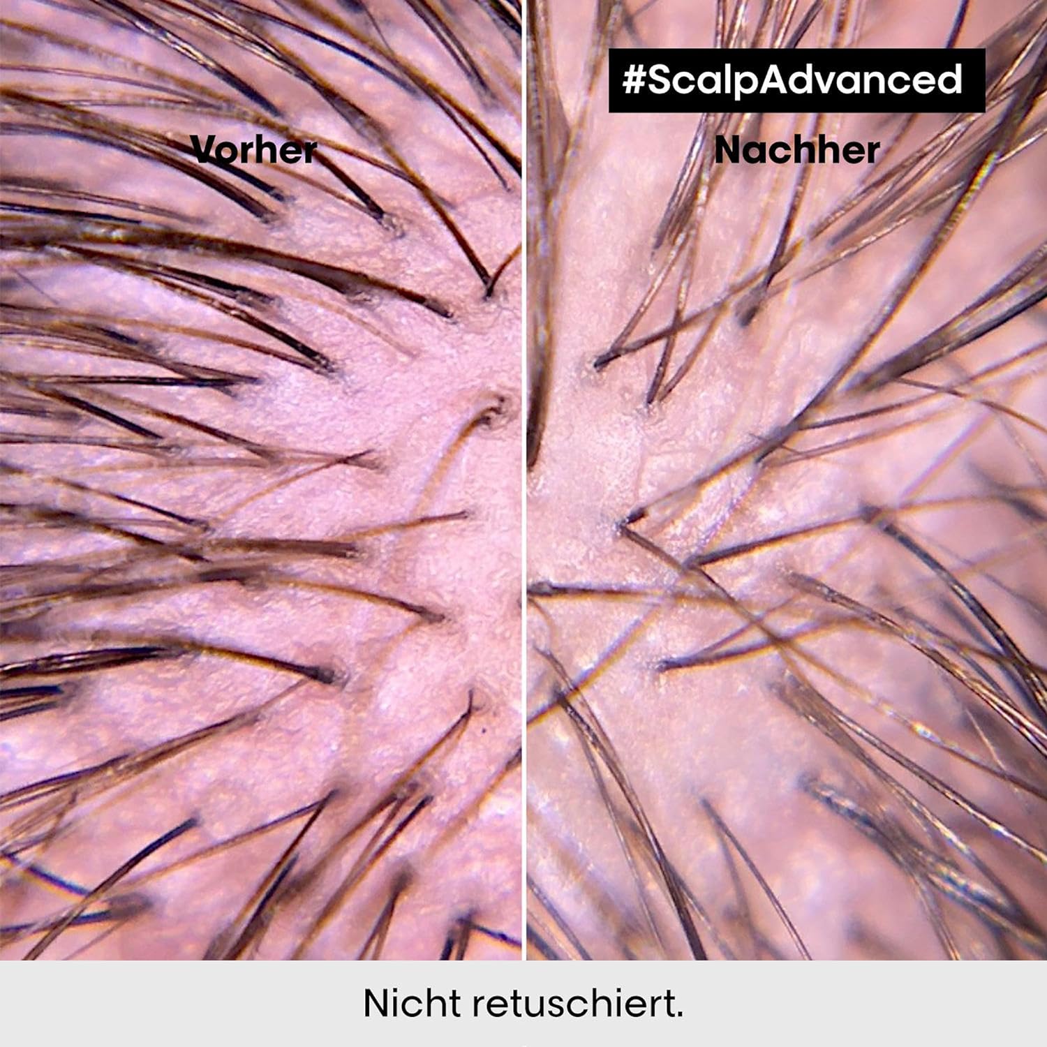 L'Oréal Professionnel Serie Expert Scalp Advanced Anti-Juckreiz Intense Soother Treatment